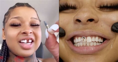 Blueface Signs Woman Who Chipped Her Tooth During Fight In。